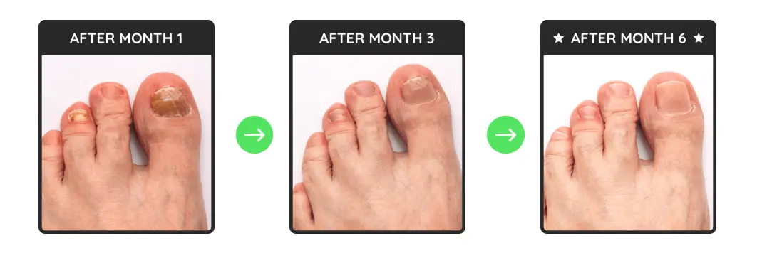Pronail Complex results within the months